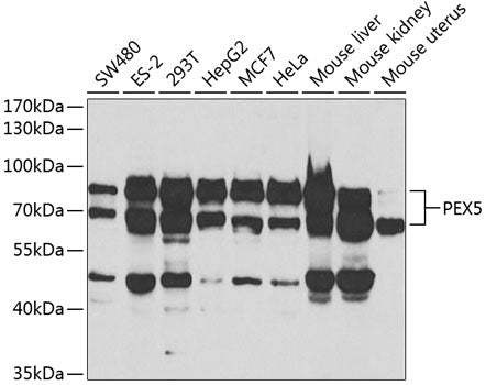 Western blot analysis of extracts of various cell lines, using PEX5 antibody  at 1:1000 dilution._Secondary antibody: HRP Goat Anti-Rabbit IgG   at 1:10000 dilution._Lysates/proteins: 25ug per lane._Blocking buffer: 3% nonfat dry milk in TBST._Detection: ECL Basic Kit ._Exposure time: 90s.