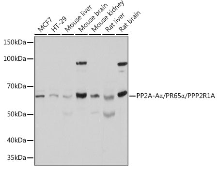 Western blot analysis of extracts of various cell lines, using PP2A-Aalpha/PR65α/PP2A-Aα/PR65α/PPP2R1A Polyclonal Antibody  at 1:500 dilution.
Secondary antibody: HRP Goat Anti-Rabbit IgG   at 1:10000 dilution.
Lysates/proteins: 25ug per lane.
Blocking buffer: 3% nonfat dry milk in TBST.
Detection: ECL Basic Kit .
Exposure time: 1s.