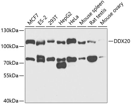 Western blot analysis of extracts of various cell lines, using DDX20 antibody  at 1:1000 dilution.
Secondary antibody: HRP Goat Anti-Rabbit IgG   at 1:10000 dilution.
Lysates/proteins: 25ug per lane.
Blocking buffer: 3% nonfat dry milk in TBST.
Detection: ECL Enhanced Kit .
Exposure time: 90s.