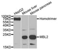 Western blot analysis of extracts of Rat liver, using MBL2 antibody  at 1:1000 dilution.
Secondary antibody: HRP Goat Anti-Rabbit IgG   at 1:10000 dilution.
Lysates/proteins: 25ug per lane.
Blocking buffer: 3% nonfat dry milk in TBST.
Detection: ECL Basic Kit .
Exposure time: 3min.