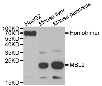 Western blot analysis of extracts of Rat liver, using MBL2 antibody  at 1:1000 dilution.
Secondary antibody: HRP Goat Anti-Rabbit IgG   at 1:10000 dilution.
Lysates/proteins: 25ug per lane.
Blocking buffer: 3% nonfat dry milk in TBST.
Detection: ECL Basic Kit .
Exposure time: 3min.