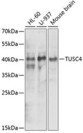 Western blot analysis of extracts of various cell lines, using NPRL2 antibody  at 1:1000 dilution.
Secondary antibody: HRP Goat Anti-Rabbit IgG   at 1:10000 dilution.
Lysates/proteins: 25ug per lane.
Blocking buffer: 3% nonfat dry milk in TBST.
Detection: ECL Enhanced Kit .
Exposure time: 90s.