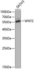 Western blot analysis of extracts of SKOV3 cells, using WNT2 Antibody  at 1:1000 dilution._Secondary antibody: HRP Goat Anti-Rabbit IgG   at 1:10000 dilution._Lysates/proteins: 25ug per lane._Blocking buffer: 3% nonfat dry milk in TBST._Detection: ECL Enhanced Kit ._Exposure time: 60s.