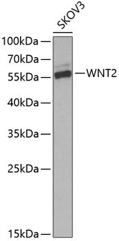 Western blot analysis of extracts of SKOV3 cells, using WNT2 Antibody  at 1:1000 dilution._Secondary antibody: HRP Goat Anti-Rabbit IgG   at 1:10000 dilution._Lysates/proteins: 25ug per lane._Blocking buffer: 3% nonfat dry milk in TBST._Detection: ECL Enhanced Kit ._Exposure time: 60s.