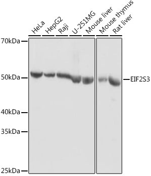 Western blot analysis of extracts of various cell lines, using EIF2S3 antibody  at 1:1000 dilution.
Secondary antibody: HRP Goat Anti-Rabbit IgG   at 1:10000 dilution.
Lysates/proteins: 25ug per lane.
Blocking buffer: 3% nonfat dry milk in TBST.
Detection: ECL Basic Kit .
Exposure time: 10s.