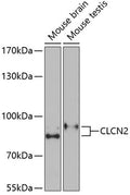 Western blot analysis of extracts of various cell lines, using CLCN2 Antibody  at 1:1000 dilution.
Secondary antibody: HRP Goat Anti-Rabbit IgG   at 1:10000 dilution.
Lysates/proteins: 25ug per lane.
Blocking buffer: 3% nonfat dry milk in TBST.
Detection: ECL Basic Kit .
Exposure time: 90s.
