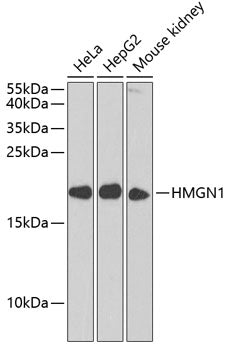 Western blot analysis of extracts of various cell lines, using HMGN1 antibody  at 1:1000 dilution._Secondary antibody: HRP Goat Anti-Rabbit IgG   at 1:10000 dilution._Lysates/proteins: 25ug per lane._Blocking buffer: 3% nonfat dry milk in TBST._Detection: ECL Enhanced Kit ._Exposure time: 30s.