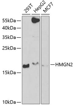 Western blot analysis of extracts of various cell lines, using HMGN2 antibody  at 1:1000 dilution.
Secondary antibody: HRP Goat Anti-Rabbit IgG   at 1:10000 dilution.
Lysates/proteins: 25ug per lane.
Blocking buffer: 3% nonfat dry milk in TBST.
Detection: ECL Basic Kit .
Exposure time: 40s.