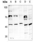 WesternBlot (WB) analysis of HAT1 polyclonal antibody