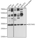 Western blot analysis of extracts of various cell lines, using SET/TAF1 antibody  at 1:1000 dilution.
Secondary antibody: HRP Goat Anti-Rabbit IgG   at 1:10000 dilution.
Lysates/proteins: 25ug per lane.
Blocking buffer: 3% nonfat dry milk in TBST.
Detection: ECL Basic Kit .
Exposure time: 30s.