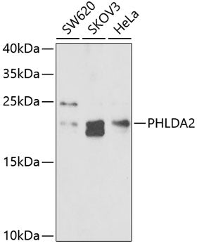 Western Blot (WB) analysis of PHLDA2 polyclonal antibody