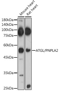 Western blot analysis of extracts of various cell lines, using ATGL/PNPLA2 antibody  at 1:1000 dilution.
Secondary antibody: HRP Goat Anti-Rabbit IgG   at 1:10000 dilution.
Lysates/proteins: 25ug per lane.
Blocking buffer: 3% nonfat dry milk in TBST.
Detection: ECL Enhanced Kit .
Exposure time: 180s.