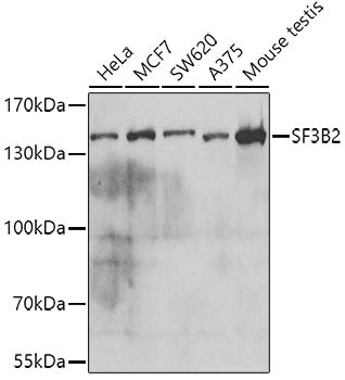 Western blot analysis of extracts of various cell lines, using SF3B2 antibody  at 1:1000 dilution.
Secondary antibody: HRP Goat Anti-Rabbit IgG   at 1:10000 dilution.
Lysates/proteins: 25ug per lane.
Blocking buffer: 3% nonfat dry milk in TBST.
Detection: ECL Basic Kit .
Exposure time: 5s.