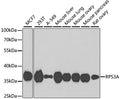 Western blot analysis of extracts of various cell lines, using RPS3A antibody  at 1:1000 dilution.
Secondary antibody: HRP Goat Anti-Rabbit IgG   at 1:10000 dilution.
Lysates/proteins: 25ug per lane.
Blocking buffer: 3% nonfat dry milk in TBST.
Detection: ECL Basic Kit .
Exposure time: 90s.