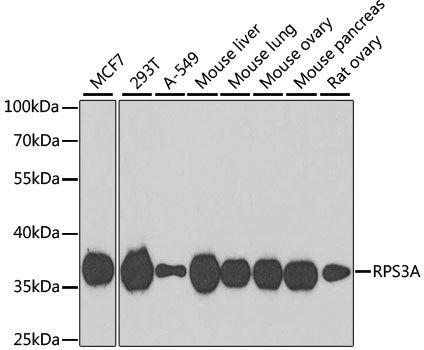 Western blot analysis of extracts of various cell lines, using RPS3A antibody  at 1:1000 dilution.
Secondary antibody: HRP Goat Anti-Rabbit IgG   at 1:10000 dilution.
Lysates/proteins: 25ug per lane.
Blocking buffer: 3% nonfat dry milk in TBST.
Detection: ECL Basic Kit .
Exposure time: 90s.