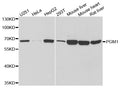PGM1 polyclonal antibody – Figure 1 of 1
