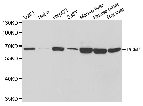 PGM1 polyclonal antibody – Figure 1 of 1
