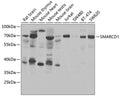 Western blot analysis of extracts of various cell lines, using SMARCD1 antibody  at 1:1000 dilution.
Secondary antibody…