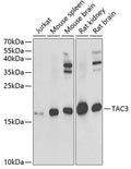 Western blot analysis of extracts of various cell lines, using TAC3 antibody  at 1:1000 dilution._Secondary antibody: HRP Goat Anti-Rabbit IgG   at 1:10000 dilution._Lysates/proteins: 25ug per lane._Blocking buffer: 3% nonfat dry milk in TBST._Detection: ECL Enhanced Kit ._Exposure time: 20s.