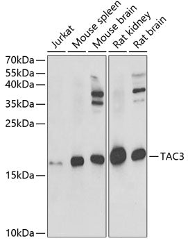 Western blot analysis of extracts of various cell lines, using TAC3 antibody  at 1:1000 dilution._Secondary antibody: HRP Goat Anti-Rabbit IgG   at 1:10000 dilution._Lysates/proteins: 25ug per lane._Blocking buffer: 3% nonfat dry milk in TBST._Detection: ECL Enhanced Kit ._Exposure time: 20s.
