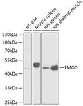 Western blot analysis of extracts of various cell lines, using FMOD antibody  at 1:1000 dilution.
Secondary antibody: HRP Goat Anti-Rabbit IgG   at 1:10000 dilution.
Lysates/proteins: 25ug per lane.
Blocking buffer: 3% nonfat dry milk in TBST.
Detection: ECL Basic Kit .
Exposure time: 90s.