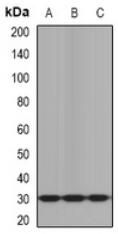Western blot analysis of KLK10 expression in mouse brain (A), mouse heart (B), rat liver (C) whole cell lysates.