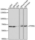 Western blot analysis of extracts of various cell lines, using PTPRN antibody  at 1:1000 dilution.
Secondary antibody: HRP Goat Anti-Rabbit IgG   at 1:10000 dilution.
Lysates/proteins: 25ug per lane.
Blocking buffer: 3% nonfat dry milk in TBST.
Detection: ECL Enhanced Kit .
Exposure time: 90s.