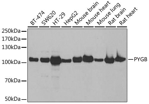 Western blot analysis of extracts of various cell lines, using PYGB antibody  at 1:1000 dilution.
Secondary antibody: HRP Goat Anti-Rabbit IgG   at 1:10000 dilution.
Lysates/proteins: 25ug per lane.
Blocking buffer: 3% nonfat dry milk in TBST.
Detection: ECL Basic Kit .
Exposure time: 30s.