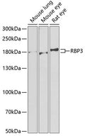 Western blot analysis of extracts of various cell lines, using RBP3 antibody  at 1:1000 dilution.
Secondary antibody: HRP…