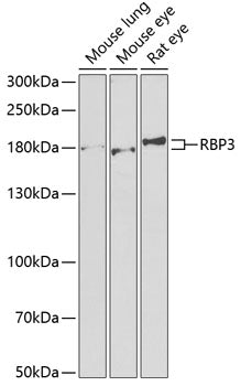 Western blot analysis of extracts of various cell lines, using RBP3 antibody  at 1:1000 dilution.
Secondary antibody: HRP…