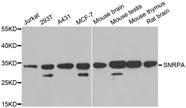 Western blot analysis of extracts of various cell lines, using U1A/U1A/SNRPA antibody  at 1:1000 dilution.
Secondary antibody: HRP Goat Anti-Rabbit IgG   at 1:10000 dilution.
Lysates/proteins: 25ug per lane.
Blocking buffer: 3% nonfat dry milk in TBST.
Detection: ECL Basic Kit .
Exposure time: 90s.