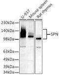 Western blot analysis of extracts of various cell lines, using   at 1:500 dilution.
Secondary antibody: HRP Goat Anti-Rabbit IgG   at 1:10000 dilution.
Lysates/proteins: 25ug per lane.
Blocking buffer: 3% nonfat dry milk in TBST.
Detection: ECL Basic Kit .
Exposure time: 180s.