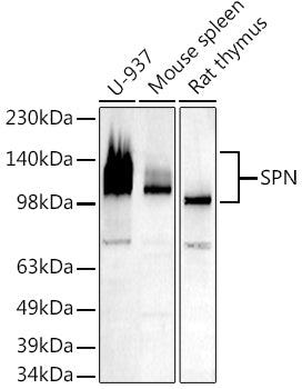 Western blot analysis of extracts of various cell lines, using   at 1:500 dilution.
Secondary antibody: HRP Goat Anti-Rabbit IgG   at 1:10000 dilution.
Lysates/proteins: 25ug per lane.
Blocking buffer: 3% nonfat dry milk in TBST.
Detection: ECL Basic Kit .
Exposure time: 180s.
