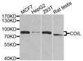 Western blot analysis of extracts of various cell lines, using Coilin antibody  at 1:1000 dilution.
Secondary antibody: HRP Goat Anti-Rabbit IgG   at 1:10000 dilution.
Lysates/proteins: 25ug per lane.
Blocking buffer: 3% nonfat dry milk in TBST.
Detection: ECL Basic Kit .
Exposure time: 90s.