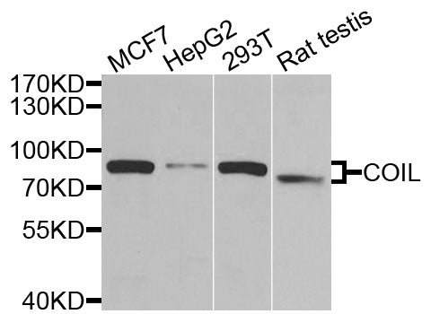 Western blot analysis of extracts of various cell lines, using Coilin antibody  at 1:1000 dilution.
Secondary antibody: HRP Goat Anti-Rabbit IgG   at 1:10000 dilution.
Lysates/proteins: 25ug per lane.
Blocking buffer: 3% nonfat dry milk in TBST.
Detection: ECL Basic Kit .
Exposure time: 90s.