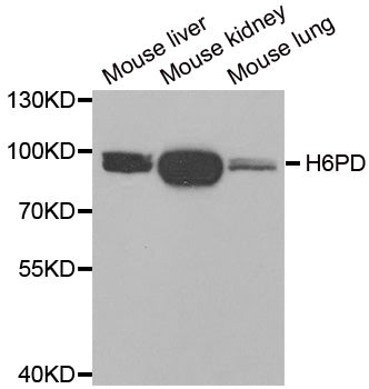Western blot analysis of extracts of various cell lines, using H6PD Antibody  at 1:1000 dilution._Secondary antibody: HRP…