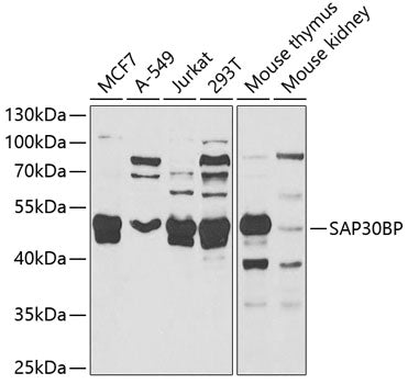 Western blot analysis of extracts of various cell lines, using SAP30BP antibody  at 1:1000 dilution.
Secondary antibody: HRP Goat Anti-Rabbit IgG   at 1:10000 dilution.
Lysates/proteins: 25ug per lane.
Blocking buffer: 3% nonfat dry milk in TBST.
Detection: ECL Basic Kit .
Exposure time: 90s.