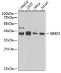 Western blot analysis of extracts of various cell lines, using NRBF2 antibody  at 1:1000 dilution.
Secondary antibody: HRP Goat Anti-Rabbit IgG   at 1:10000 dilution.
Lysates/proteins: 25ug per lane.
Blocking buffer: 3% nonfat dry milk in TBST.
Detection: ECL Enhanced Kit .
Exposure time: 90s.