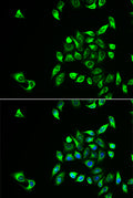 Immunofluorescence analysis of HeLa cell using CSNK1A1L antibody. Blue: DAPI for nuclear staining.