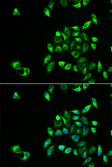 Immunofluorescence analysis of HeLa cell using CSNK1A1L antibody. Blue: DAPI for nuclear staining.