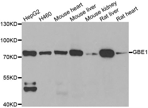 WesternBlot (WB) analysis of GBE1 polyclonal antibody