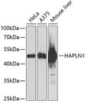 WesternBlot (WB) analysis of HAPLN1 polyclonal antibody