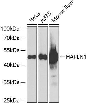 WesternBlot (WB) analysis of HAPLN1 polyclonal antibody