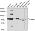 Western blot analysis of extracts of various cell lines, using IRAK2 antibody  at 1:1000 dilution.
Secondary antibody: HRP Goat Anti-Rabbit IgG   at 1:10000 dilution.
Lysates/proteins: 25ug per lane.
Blocking buffer: 3% nonfat dry milk in TBST.
Detection: ECL Basic Kit .
Exposure time: 90s.