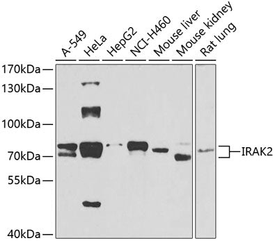 Western blot analysis of extracts of various cell lines, using IRAK2 antibody  at 1:1000 dilution.
Secondary antibody: HRP Goat Anti-Rabbit IgG   at 1:10000 dilution.
Lysates/proteins: 25ug per lane.
Blocking buffer: 3% nonfat dry milk in TBST.
Detection: ECL Basic Kit .
Exposure time: 90s.