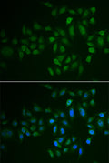 Immunofluorescence analysis of U2OS cells using MYLK3 antibody . Blue: DAPI for nuclear staining.