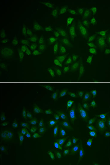 Immunofluorescence analysis of U2OS cells using MYLK3 antibody . Blue: DAPI for nuclear staining.