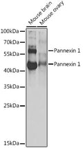 Western blot analysis of extracts of various cell lines, using Pannexin 1 antibody  at 1:1000 dilution.
Secondary antibody: HRP Goat Anti-Rabbit IgG   at 1:10000 dilution.
Lysates/proteins: 25ug per lane.
Blocking buffer: 3% nonfat dry milk in TBST.
Detection: ECL Basic Kit .
Exposure time: 30s.