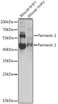 Western blot analysis of extracts of various cell lines, using Pannexin 1 antibody  at 1:1000 dilution.
Secondary antibody: HRP Goat Anti-Rabbit IgG   at 1:10000 dilution.
Lysates/proteins: 25ug per lane.
Blocking buffer: 3% nonfat dry milk in TBST.
Detection: ECL Basic Kit .
Exposure time: 30s.