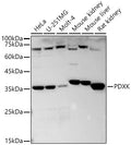 Western blot analysis of extracts of various cell lines, using PDXK antibody  at  1:640 dilution.
Secondary antibody: HRP Goat Anti-Rabbit IgG   at 1:10000 dilution.
Lysates/proteins: 25ug per lane.
Blocking buffer: 3% nonfat dry milk in TBST.
Detection: ECL Basic Kit .
Exposure time: 30s.